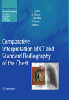 Comparative Interpretation of CT and Standard Radiography of the Chest-1