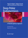 Deep Pelvic Endometriosis -1