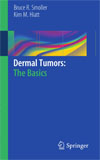 Dermal Tumors