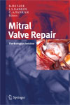 Mitral Valve Repair-1