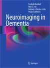 Neuroimaging in Dementia-1
