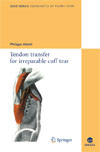 Tendon transfer for irreparable cuff tear-1