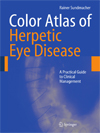 Color Atlas of Herpetic Eye Diseases-1