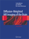 Diffusion
