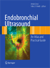Endobronchial Ultrasound-1