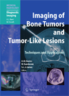Imaging of Bone Tumors and Tumor