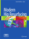 Modern Hip Resurfacing-1