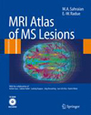MRI Atlas of MS Lesions-1