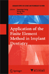 Application of the Finite Element Method in Implant Dentistry-1