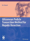 Glissonean Pedicle Transection Method for Hepatic Resection-1