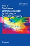 Atlas of Non-Invasive Coronary Angiography by Multidetector Computed Tomography-1
