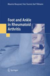 Foot and ankle in rheumatoid arthritis-1