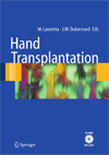 Hand Transplantation-1