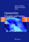 Liposuction-1