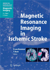 Magnetic Resonance Imaging in Ischemic Stroke-1