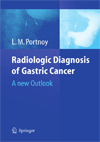 Radiologic Diagnosis of Gastric Cancer-1