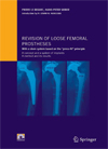 Revision of Loose Femoral Prostheses-1