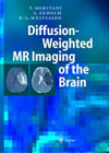 Diffusion Weighted MR Imaging of the Brain-1