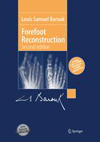 Forefoot Reconstruction-1