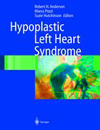 Hypoplastic Left Heart Syndrome-1
