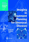 Imaging in Treatment Planning for Sinonasal Diseases-1
