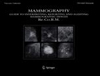 Mammography-1