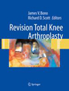Revision Total Knee Arthroplasty-1