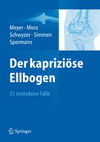 Der kapriziose Ellbogen-1
