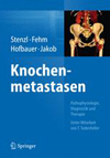 Knochenmetastasen-1