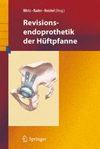 Revisionsendoprothetik der Huftpfanne-1