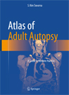 Atlas of Adult Autopsy a Guide to Modern Practice 2016-1