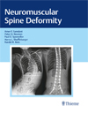 Neuromuscular Spine Deformity -1