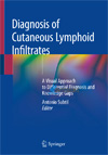 Diagnosis of Cutaneous Lymphoid Infiltrates 1st Edition-1