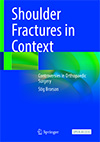 Shoulder Fractures in Context